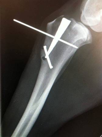 Lexi xray