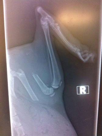 Gingernut xray
